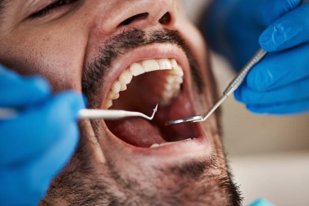 Urgent Tooth Repair in NE